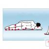 Как проводить массаж лежачему больному Требуется массажист для лежачего больного после травмы