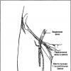 Техники катетеризации бедренной вены Катетеризация бедренной артерии